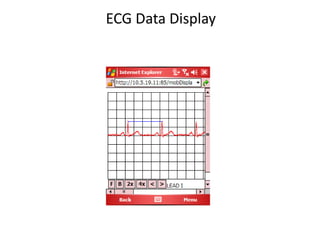 ECG Data Display
 