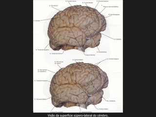 Visão da superfície súpero-lateral do cérebro.
 