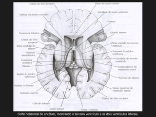 Corte horizontal do encéfalo, mostrando o terceiro ventrículo e os dois ventrículos laterais.
 