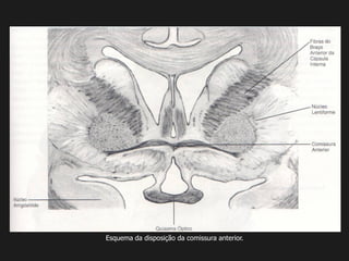 Esquema da disposição da comissura anterior.
 
