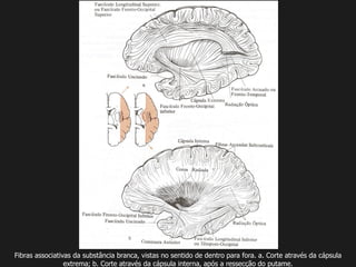 Fibras associativas da substância branca, vistas no sentido de dentro para fora. a. Corte através da cápsula
extrema; b. Corte através da cápsula interna, após a ressecção do putame.
 