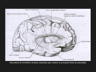 Vista lateral do hemisfério cerebral, dissecado para mostrar as principais fibras de associação.
 