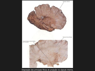 Disposição das principais fibras de projeção na cápsula interna.
 