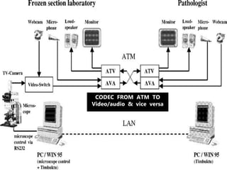 CODEC FROM ATM TO
Video/audio & vice versa
 