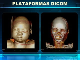 PLATAFORMAS DICOM




            Ejemplos realizados en plataforma Osirix
 