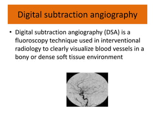 Teleradiology.ppt