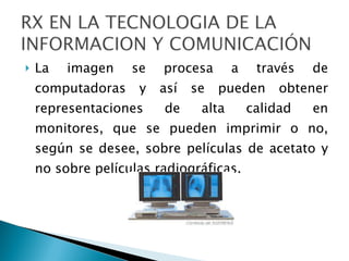 La imagen se procesa a través de computadoras y así se pueden obtener representaciones de alta calidad en monitores, que se pueden imprimir o no, según se desee, sobre películas de acetato y no sobre películas radiográficas. 