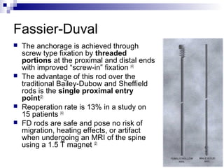 Telescopic nails in Osteogenesis Imperfecta | PPT