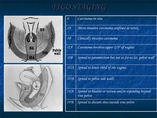 FIGO STAGING Carcinoma-in-situ 0 Spread to bladder or rectum and/or extending beyond true pelvis IVA Spread to lower third of the vagina IIIA Spread to pelvic side walls IIIB Spread to parametrium but not as far as lat. pelvic wall IIB Spread to distant sites outside true pelvis IVB Carcinoma involves upper 2/3 rd  of vagina IIA Clinically invasive carcinoma IB Micro invasive carcinoma confined to cervix IA 