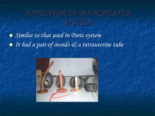 APPICATOR IN MANCHESTER SYSTEM Similar to that used in Paris system It had a pair of ovoids & a intrauterine tube 