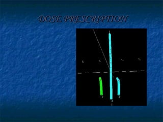 DOSE PRESCRIPTION 