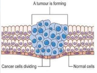 CANCER-a brief introduction
• Cancer is actually a group of many related diseases that
all have to do with cells. Cancer happens when cells that
are not normal grow and spread very fast. Normal body
cells grow and divide and know to stop growing. Over
time, they also die. Unlike these normal cells, cancer cells
just continue to grow and divide out of control and don't
die when they're supposed to.
• Cancer cells usually group or clump together to form
tumors A growing tumor becomes a lump of cancer cells
that can destroy the normal cells around the tumor and
damage the body's healthy tissues. Sometimes cancer
cells break away from the original tumor and travel to
other areas of the body, where they keep growing and
can go on to form new tumors. This is how cancer
spreads. The spread of a tumor to a new place in the
body is called Metastasis
 
