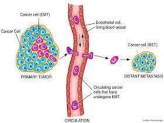 HALL MARKS OF CANCER
• Cancer has 6 major hallmarks
IMMORTALITY CONTINOUS CELL DIVISION AND LIMIT
LESS CELL DIVISION
PRODUCE GO SIGNAL GROWTH FACTOR FROM ONCOGENES
OVER RIDE STOP SIGNALS OVERIDE STOP SIGNAL
RESISTANCE TO CELL DEATH APPOTOSIS
ANGIOGENESIS INDUCTION OF NEW BLOOD VESSELS
GROWTH
METASTASIS SPREAD TO OTHER CELLS
 