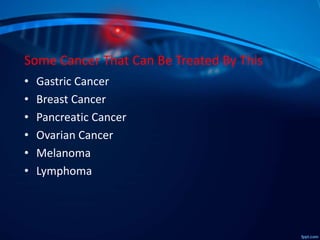 Some Cancer That Can Be Treated By This
• Gastric Cancer
• Breast Cancer
• Pancreatic Cancer
• Ovarian Cancer
• Melanoma
• Lymphoma
 