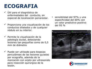 ECOGRAFIA
 Útil para el diagnóstico de
enfermedades del conducto, en
especial de localización periareolar.
 Proporciona una visualización de los
conductos dilatados y de cualquier
nódulo en su interior.
 Permite la visualización de la
patología ductal, detectando
lesiones tan pequeñas como de 0,5
mm de diámetro
 Puede ser utilizado para biopsias
percutáneas de las lesiones guiadas
por ecografía, además de la
marcación con arpón por ultrasonido
para resección quirúrgica de la
lesión.
• sensibilidad del 97% y una
especificidad del 60% con
un valor predictivo positivo
del 95 %
 