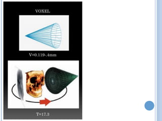 VOXEL
V=0.119-.4mm
T=17.3
 