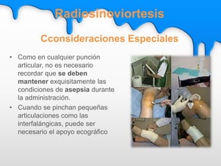 • Como en cualquier punción
articular, no es necesario
recordar que se deben
mantener exquisitamente las
condiciones de asepsia durante
la administración.
• Cuando se pinchan pequeñas
articulaciones como las
interfalángicas, puede ser
necesario el apoyo ecográfico
Radiosinoviortesis
Cconsideraciones Especiales
 