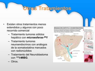 • Existen otros tratamientos menos
extendidos y algunos con poco
recorrido comercial
– Tratamiento tumores sólidos
hepático con microesferas-90Y
– Tratamiento tumores
neuroendocrinos con análogos
de la somatostatina marcados
con radionúclidos
– Tratamiento del Neuroblastoma
con 131I-MIBG.
– Otros.
Otros Tratamientos
 