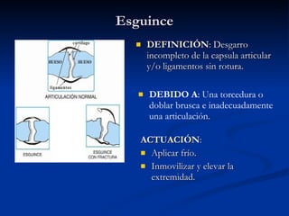 Esguince DEFINICIÓN : Desgarro incompleto de la capsula articular y/o ligamentos sin rotura. ACTUACIÓN : Aplicar frío. Inmovilizar y elevar la extremidad. DEBIDO A : Una torcedura o doblar brusca e inadecuadamente una articulación. 