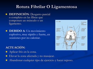 Rotura Fibrilar O Ligamentosa DEFINICIÓN : Desgarro parcial o completo en las fibras que componen un músculo o un ligamento. ACTUACIÓN : Aplicar frío en la zona. Elevar la zona afectada y no masajear. Abandonar cualquier tipo de ejercicio y hacer reposo. DEBIDO A : Un movimiento explosivo, muy rápido y fuerte, en ocasiones por no calentar. 