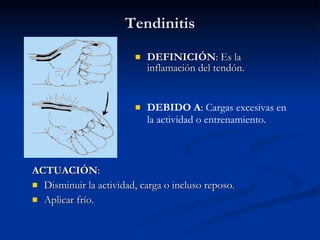Tendinitis DEFINICIÓN : Es la inflamación del tendón. ACTUACIÓN : Disminuir la actividad, carga o incluso reposo. Aplicar frío. DEBIDO A : Cargas excesivas en la actividad o entrenamiento. 