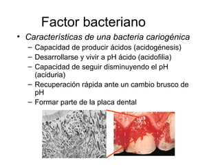 Factor bacteriano
• Características de una bacteria cariogénica
– Capacidad de producir ácidos (acidogénesis)
– Desarrollarse y vivir a pH ácido (acidofilia)
– Capacidad de seguir disminuyendo el pH
(aciduria)
– Recuperación rápida ante un cambio brusco de
pH
– Formar parte de la placa dental
 