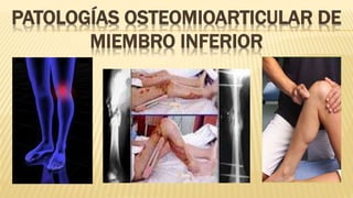 PATOLOGÍAS OSTEOMIOARTICULAR DE
MIEMBRO INFERIOR
 