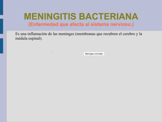 Microorganismos patógenos pluricelulares: hongos  (producen enfermedades en la 