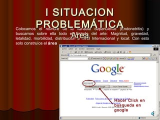 I SITUACION
           PROBLEMÁTICA
Colocamos el nombre de la variable dependiente (Endonetritis) y

                               Area
buscamos sobre ella todo el Estado del arte: Magnitud, gravedad,
letalidad, morbilidad, distribución a nivel Internacional y local: Con esto
solo construíos el área




                                                       Hacer Click en
                                                       busqueda en
                                                       google
 