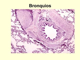 Bronquios
 