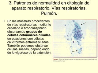 3. Patrones de normalidad en citología de
aparato respiratorio. Vías respiratorias.
Pulmón.
• En las muestras procedentes
de vías respiratorias mediante
cepillado o broncoaspirado
observamos grupos de
células columnares ciliadas,
en ocasiones con células
caliciformes entremezcladas.
También podemos observar
células sueltas, dependiendo
de lo vigoroso de la extensión.
 