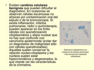 • Existen cambios celulares
benignos que pueden dificultar el
diagnóstico. En ocasiones se
observan células escamosas no
atípicas por contaminación oral del
esputo o de la broncoscopia. Si
existe inflamación, infartos
pulmonares, radio o quimioterapia,
pueden aparecer en los frotis
células con queratinización
citoplasmática y atipia nuclear que
no hay que confundir con
carcinoma epidermoide (evitar dar
un diagnóstico de malignidad sólo
con células queratinizadas).
Aquellas suelen conservar la
relación núcleo-citoplasma y los
núcleos suelen estar
hipercromáticos y degenerados, lo
que impide ver las características
de la cromatina.
Extensión insatisfactoria con
presencia de células escamosas
más oscuras por respuesta
inflamatoria
 