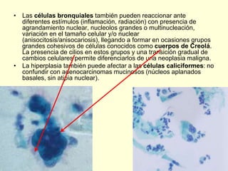 • Las células bronquiales también pueden reaccionar ante
diferentes estímulos (inflamación, radiación) con presencia de
agrandamiento nuclear, nucleolos grandes o multinucleación,
variación en el tamaño celular y/o nuclear
(anisocitosis/anisocariosis), llegando a formar en ocasiones grupos
grandes cohesivos de células conocidos como cuerpos de Creolá.
La presencia de cilios en estos grupos y una transición gradual de
cambios celulares permite diferenciarlos de una neoplasia maligna.
• La hiperplasia también puede afectar a las células caliciformes: no
confundir con adenocarcinomas mucinosos (núcleos aplanados
basales, sin atipia nuclear).
 
