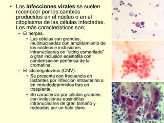 • Las infecciones virales se suelen
reconocer por los cambios
producidos en el núcleo o en el
citoplasma de las células infectadas.
Los más característicos son:
– El herpes.
• Las células son grandes,
multinucleadas con amoldamiento de
los núcleos e inclusiones
intranucleares en “vidrio esmerilado”
o gran inclusión eosinófila con
condensación periférica de la
cromatina.
– El citomegalovirus (CMV).
• Se presenta con frecuencia en
lactantes por infección intrauterina o
en inmudodeprimidos tras un
trasplante.
• Se caracteriza por células grandes
con inclusiones eosinófilas
intranucleares de gran tamaño y
rodeadas por un halo claro.
 