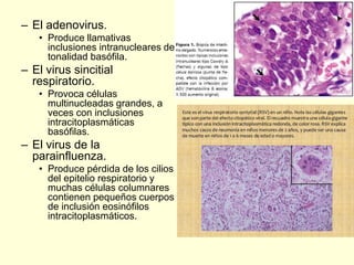 – El adenovirus.
• Produce llamativas
inclusiones intranucleares de
tonalidad basófila.
– El virus sincitial
respiratorio.
• Provoca células
multinucleadas grandes, a
veces con inclusiones
intracitoplasmáticas
basófilas.
– El virus de la
parainfluenza.
• Produce pérdida de los cilios
del epitelio respiratorio y
muchas células columnares
contienen pequeños cuerpos
de inclusión eosinófilos
intracitoplasmáticos.
 