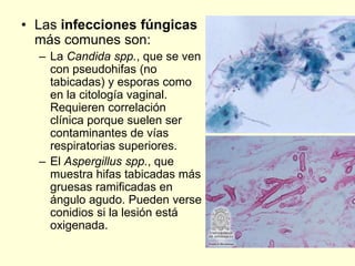 • Las infecciones fúngicas
más comunes son:
– La Candida spp., que se ven
con pseudohifas (no
tabicadas) y esporas como
en la citología vaginal.
Requieren correlación
clínica porque suelen ser
contaminantes de vías
respiratorias superiores.
– El Aspergillus spp., que
muestra hifas tabicadas más
gruesas ramificadas en
ángulo agudo. Pueden verse
conidios si la lesión está
oxigenada.
 