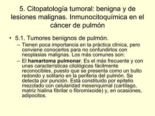 5. Citopatología tumoral: benigna y de
lesiones malignas. Inmunocitoquímica en el
cáncer de pulmón
• 5.1. Tumores benignos de pulmón.
– Tienen poca importancia en la práctica clínica, pero
conviene conocerlos para no confundirlos con
neoplasias malignas. Los más comunes son:
– El hamartoma pulmonar. Es el más frecuente y con
unas características citológicas fácilmente
reconocibles, puesto que se presenta como un bulto
redondo y solitario en la periferia del pulmón. Se
detecta por punción. Está constituido por epitelio
mezclado con celularidad mesenquimal (cartílago,
matriz hialina fibrilar o fibromixoide) y, en ocasiones,
adipocitos.
 