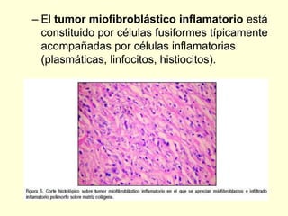 – El tumor miofibroblástico inflamatorio está
constituido por células fusiformes típicamente
acompañadas por células inflamatorias
(plasmáticas, linfocitos, histiocitos).
 