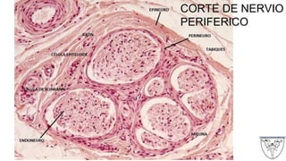 CORTE DE NERVIO
PERIFERICO
 