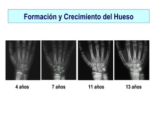 Formación y Crecimiento del Hueso
4 años 7 años 11 años 13 años
 