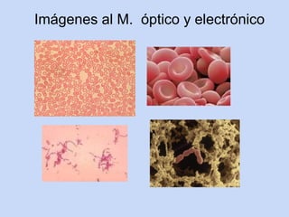 Imágenes al M. óptico y electrónico
 