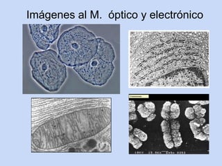 Imágenes al M. óptico y electrónico
 