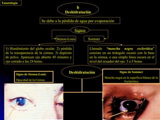 Tanatología
                                                b
                                          Deshidratación

                           Se debe a la pérdida de agua por evaporación

                                                  Signos

                                    Stenon-Louis           Sommer

  1) Hundimiento del globo ocular. 2) pérdida              Llamado “mancha negra esclerótica”
  de la transparencia de la córnea. 3) depósito            consiste en un triángulo oscuro con la base
  de polvo. Aparecen ojo abierto 45 minutos y              en la córnea, o una simple línea oscura en el
  ojo cerrado a las 24 horas.                              nivel del ecuador del ojo. 3 a 5 horas.


         Signo de Stenon-Louis.
                                             Deshidratación                     Signo de Sommer
                                                                     Mancha negra en la superficie blanca de la
         Opacidad de la Córnea                                                     Esclerótica
 