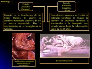 Tanatología
                                                           Periodo
                        Periodo
                                                          Reducción
                       Colicuativo
                                                          Esquelética
                       (Semanas)
                                                            (Años)

   Consiste en la licuefacción de los         Generalmente alcanza a los 5 años en
   tejidos blandos. El cadáver se             cadáveres sepultados en bóvedas de
   deshidrata totalmente confiere a la piel   cemento. En cadáveres enterrados o
   un aspecto acaramelado. Hay la             abandonados a la intemperie, este
   transformación de la hemoglobina en        periodo avanza hasta la pulverización.
   hematina.                                  Lapso de 5 a 10 años.




              La piel adquiere un aspecto          Reducción Esquelética
                  acaramelado por la
                     Licuefacción
 