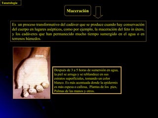 Tanatología

                                         Maceración


       Es un proceso transformativo del cadáver que se produce cuando hay conservación
       del cuerpo en lugares asépticos, como por ejemplo, la maceración del feto in útero,
       y los cadáveres que han permanecido mucho tiempo sumergido en el agua o en
       terrenos húmedos.




                                 Después de 3 a 5 horas de sumersión en agua,
                                 la piel se arruga y se reblandece en sus
                                 estratos superficiales, tomando un color
                                 blanco. Es más acentuada donde la epidermis
                                 es más espesa o callosa, Plantas de los pies,
                                 Palmas de las manos y otros.
 