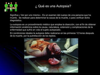 ¿ Qué es una Autopsia?

Significa « Ver por uno mismo» . Es un examen del cuerpo de una persona que ha
muerto. Se realizan para determinar la causa de la muerte, o para verificar dicho
diagnóstico.
La autopsia es un procedimiento médico que emplea la disección, con el fin de obtener
información anatómica sobre la causa, naturaleza, extensión y complicaciones de la
enfermedad que sufrió en vida el sujeto autopsiado.
En condiciones ideales la autopsia debe realizarse en las primeras 12 horas después
de la muerte, por la putrefacción de los tejidos.
 