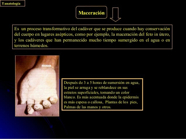 La salud el grupo del adelgazamiento