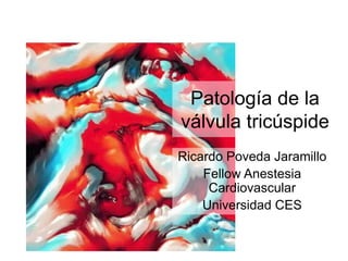 Patología de la
válvula tricúspide
Ricardo Poveda Jaramillo
Fellow Anestesia
Cardiovascular
Universidad CES
 