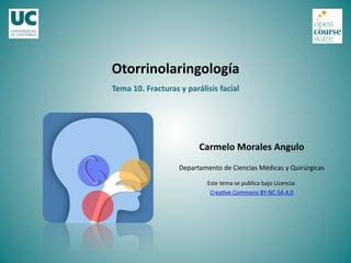 Otorrinolaringología	
  
Carmelo	
  Morales	
  Angulo	
  
Departamento	
  de	
  Ciencias	
  Médicas	
  y	
  Quirúrgicas	
  
Este	
  tema	
  se	
  publica	
  bajo	
  Licencia:	
  
Crea=ve	
  Commons	
  BY-­‐NC-­‐SA	
  4.0	
  
Tema	
  10.	
  Fracturas	
  y	
  parálisis	
  facial	
  
 