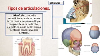 Tipos de articulaciones.
c) Gonfosis cuando las
superficies articulares tienen
forma cónica simple o múltiple,
congruentes una de la otra,
ejemplo, la unión de las piezas
dentarias con los alveolos
dentales.
b) Suturas
 
